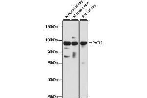 Image no. 1 for anti-Protein Associated with Topoisomerase II Homolog 1 (PATL1) antibody (ABIN6293952)