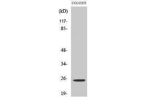 Western Blotting (WB) image for anti-Homeobox A7 (HOXA7) (Internal Region) antibody (ABIN3180675)
