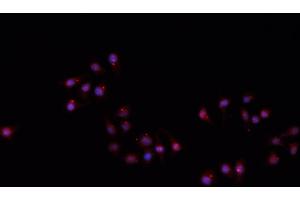 Image no. 2 for anti-Hairless (HR) antibody (ABIN6262146)