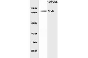 LDLR antibody  (AA 781-860)