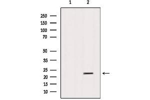 Image no. 3 for anti-SAR1 Homolog B (SAR1B) (Internal Region) antibody (ABIN6259183)