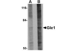 Image no. 1 for anti-GLE1 RNA Export Mediator (GLE1) (Center) antibody (ABIN499894)