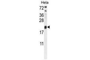 Image no. 2 for anti-Trafficking Protein Particle Complex 3 (TRAPPC3) (AA 24-54), (N-Term) antibody (ABIN955322)