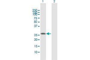 Western Blot analysis of SLA2 expression in transfected 293T cell line by SLA2 MaxPab polyclonal antibody.