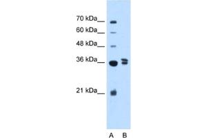 Image no. 1 for anti-Transcription Factor B1, Mitochondrial (TFB1M) antibody (ABIN2460979)