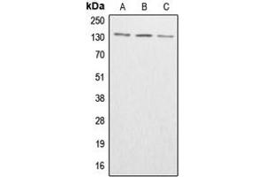 Image no. 3 for anti-Abelson Murine Leukemia Viral Oncogene Homolog 1/2 (ABL1/ABL2) (C-Term), (pTyr393), (pTyr439) antibody (ABIN2704442)