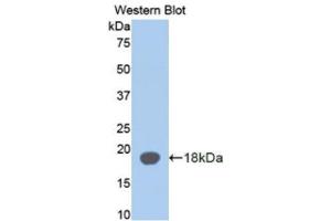 Image no. 1 for anti-alpha-2-Glycoprotein 1, Zinc-Binding (AZGP1) antibody (Biotin) (ABIN1171671)