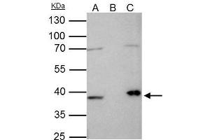 Image no. 3 for anti-Fibrillarin (FBL) (Center) antibody (ABIN2855179)