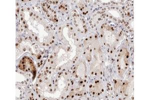 Image no. 1 for anti-Nuclear Factor of kappa Light Polypeptide Gene Enhancer in B-Cells 2 (NFKB2) (pSer866) antibody (ABIN6256439)