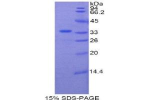 Image no. 1 for Plexin B1 (PLXNB1) (AA 1780-2042) protein (His tag) (ABIN1877246)