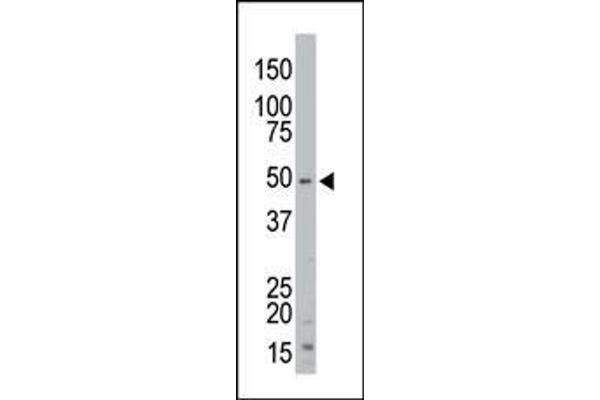 anti-Serine/threonine Kinase 35 (STK35) (Center) antibody
