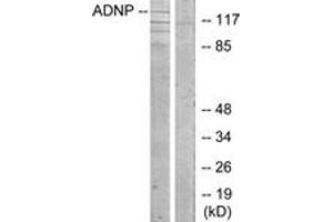 Image no. 1 for anti-Activity-Dependent Neuroprotector Homeobox (ADNP) (AA 111-160) antibody (ABIN1534122)