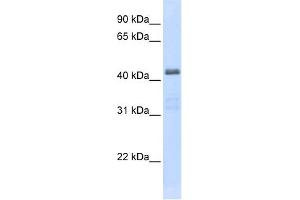 Image no. 5 for anti-Solute Carrier Family 29 (Nucleoside Transporters), Member 2 (SLC29A2) (C-Term) antibody (ABIN2781572)