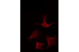 Image no. 1 for anti-Ubiquitin Specific Peptidase 43 (USP43) (N-Term) antibody (ABIN6258350)