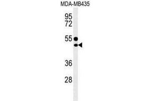 Image no. 4 for anti-CD1e (CD1e) (AA 274-304), (Middle Region) antibody (ABIN951216)