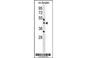 Image no. 1 for anti-Hyaluronan and Proteoglycan Link Protein 4 (HAPLN4) (AA 331-357), (C-Term) antibody (ABIN1537145)