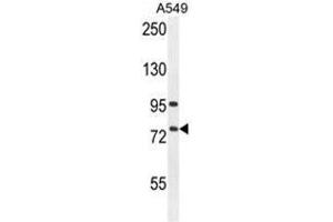 Image no. 1 for anti-Arachidonate 12-Lipoxygenase, 12R Type (ALOX12B) (AA 629-660), (C-Term) antibody (ABIN950354)