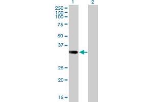 Image no. 4 for anti-Signal Sequence Receptor, alpha (SSR1) (AA 1-286) antibody (ABIN520502)