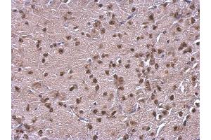 Image no. 2 for anti-Nuclear Factor I/B (NFIB) (Center) antibody (ABIN2856178)