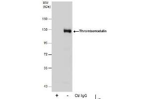 Image no. 3 for anti-Thrombomodulin (THBD) (C-Term) antibody (ABIN2856586)
