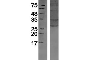 Image no. 2 for anti-Glycophorin C (GYPC) (AA 31-128) antibody (ABIN718991)