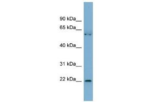 anti-Slowmo Homolog 2 (SLMO2) (N-Term) antibody