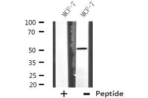 Western blot analysis of extracts from MCF-7 cells, using HUCE1 antibody.