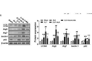 ATG5 Antikörper  (AA 1-275)