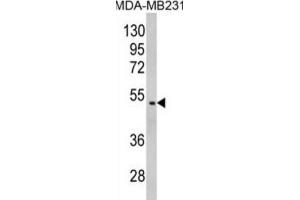 Image no. 2 for anti-Galactose-1-Phosphate Uridylyltransferase (GALT) antibody (ABIN3002853)