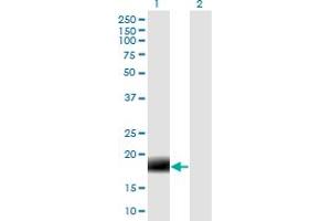 anti-Membrane-Associated Ring Finger (C3HC4) 2, E3 Ubiquitin Protein Ligase (MARCH2) (AA 1-176) antibody