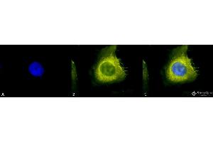 Image no. 2 for anti-Cell Division Cycle 37 Homolog (S. Cerevisiae) (CDC37) antibody (FITC) (ABIN2484526)