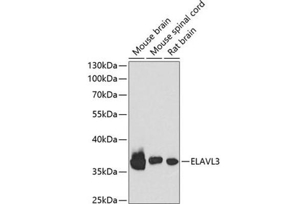 HuC/ELAVL3 Antikörper  (AA 1-100)
