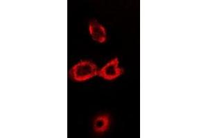 Image no. 2 for anti-Solute Carrier Family 7 (Cationic Amino Acid Transporter, Y+ System), Member 1 (SLC7A1) (full length) antibody (ABIN6004668)