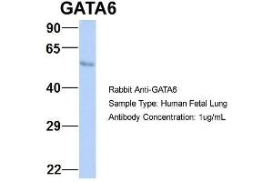 Image no. 2 for anti-GATA Binding Protein 6 (GATA6) (N-Term) antibody (ABIN2779715)