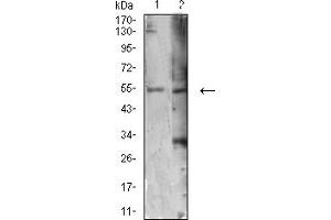 Image no. 4 for anti-Autophagy related 4C Cysteine Peptidase (ATG4C) (AA 321-458) antibody (ABIN5611292)