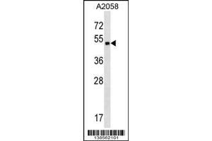 Image no. 1 for anti-Zinc Finger Protein 559 (ZNF559) (Center) antibody (ABIN2494637)