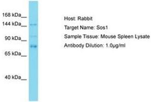 Image no. 1 for anti-Son of Sevenless Homolog 1 (SOS1) (AA 353-402) antibody (ABIN6750497)
