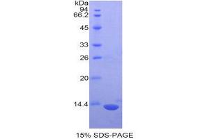 Image no. 1 for S100 Protein (S100) (AA 2-94) protein (His tag) (ABIN1877707)