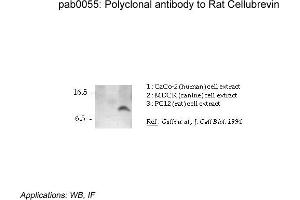 Image no. 1 for anti-Vesicle-Associated Membrane Protein 3 (VAMP3) (N-Term) antibody (ABIN347006)