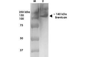 Western Blot analysis of Rat Brain Membrane showing detection of ~140 kDa Brevican protein using Mouse Anti-Brevican Monoclonal Antibody, Clone S294A-6 .
