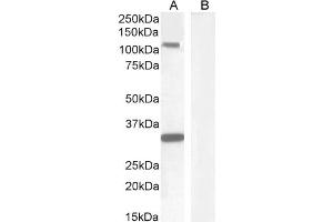 Image no. 4 for anti-Mast/stem Cell Growth Factor Receptor (KIT) (Internal Region) antibody (ABIN1589992)