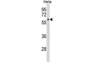 Image no. 1 for anti-Cytochrome P450, Family 7, Subfamily B, Polypeptide 1 (CYP7B1) (Middle Region) antibody (ABIN453610)