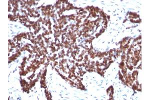 Image no. 3 for anti-Cyclin B1 (CCNB1) antibody (ABIN6940990)