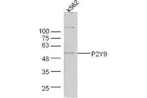 Image no. 4 for anti-Lysophosphatidic Acid Receptor 4 (LPAR4) (AA 175-270) antibody (ABIN1387771)