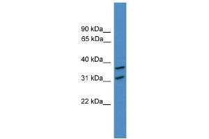 Image no. 2 for anti-OTU Domain Containing 6A (OTUD6A) (N-Term) antibody (ABIN2774251)