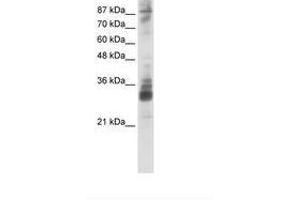 Image no. 1 for anti-RNA (Guanine-9-) Methyltransferase Domain Containing 2 (RG9MTD2) (AA 181-230) antibody (ABIN202281)