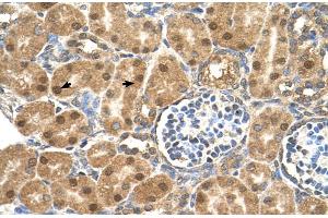 Image no. 3 for anti-Prostaglandin D2 Synthase (PTGDS) (N-Term) antibody (ABIN2783248)