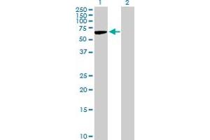 Image no. 2 for anti-Trophoblast Glycoprotein (TPBG) (AA 1-420) antibody (ABIN521050)