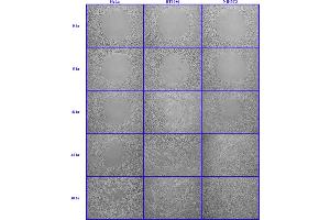 Image no. 2 for Radius™ 24-Well Cell Migration Assay (ABIN2344873)
