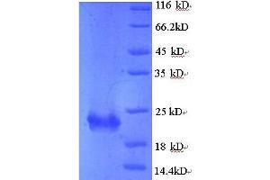 SDS-PAGE (SDS) image for Kruppel-Like Factor 6 (KLF6) (AA 27-207) protein (His tag) (ABIN5714170)